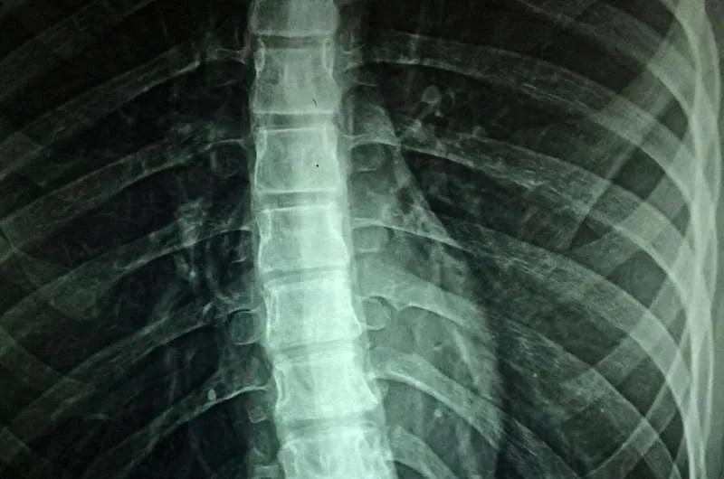 Tiny, Flexible Spinal Probe System