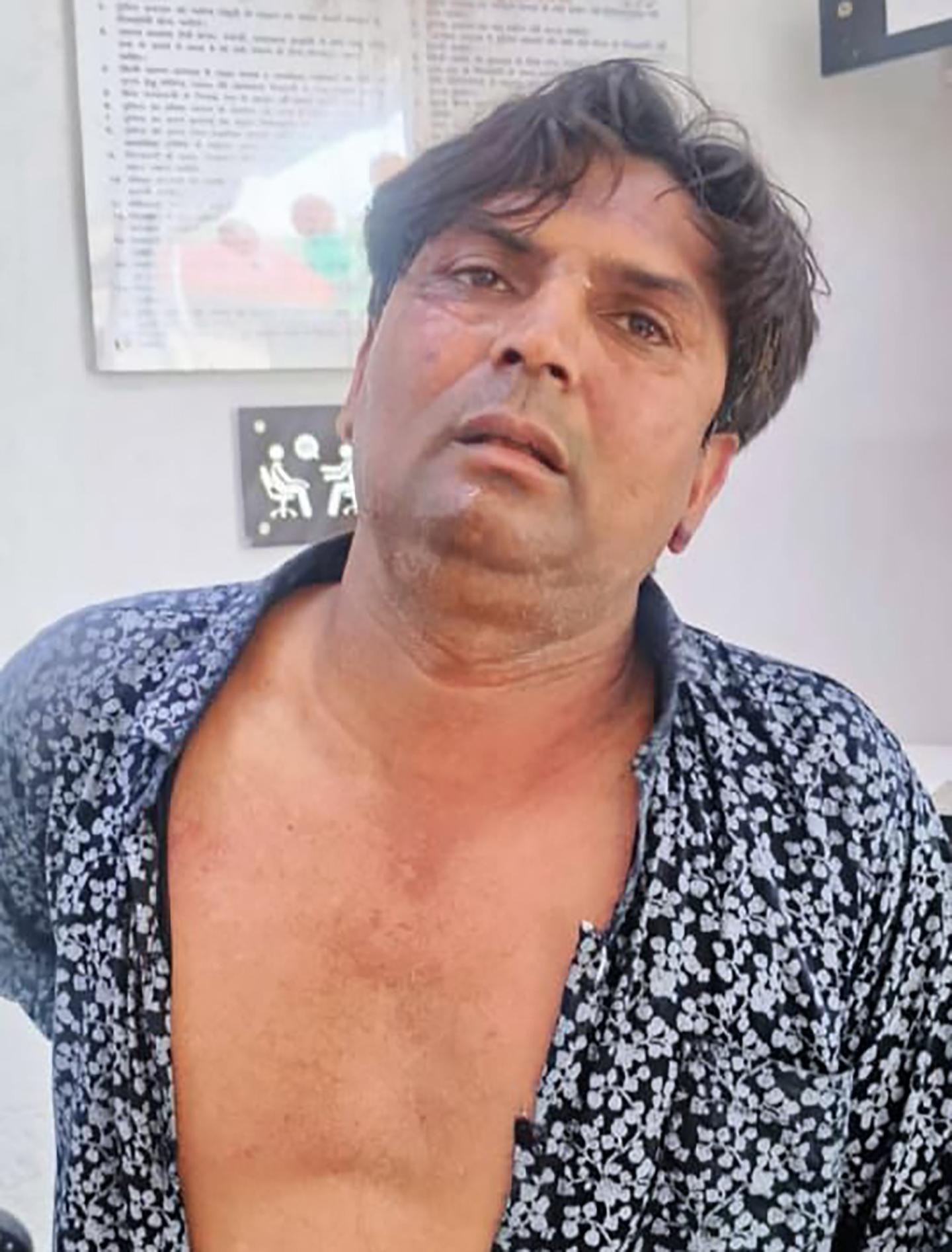 Delhi CM assault: Rajesh Khimji to be produced in court today