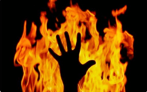 Man-son duo set afire: 12-year-old dies, father sustains burns in Bihar's Katihar