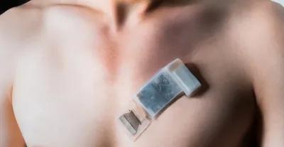 New Wearable Ultrasound System